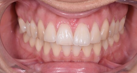 Fototapeta premium Dental