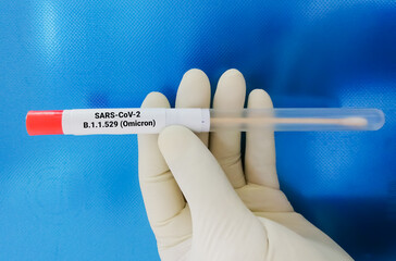 Technician holding COVID-19 swab collection kit for Omicron variant test, OP or NP patient specimen...