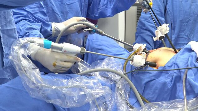 Close up of hands of surgeons team during laparoscopy instruments