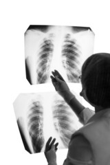 Doctor or radiologist examines a chest x-ray of a patient in a hospital. The concept of...