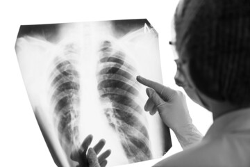 Doctor or radiologist examines a chest x-ray of a patient in a hospital. The concept of...