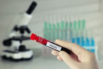 Scientist holding test tube with blood sample and label Anemia on blurred background, closeup - obrazy, fototapety, plakaty