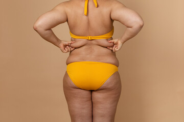 Cropped image of overweight fat woman back with obesity, excess fat in yellow swimsuit. Big size. Holding waist flabs, visceral, cellulite. Varicose veins, imperfection skin puffy body. Liposuction - Powered by Adobe