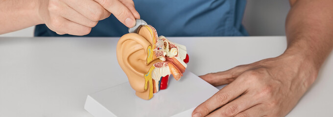 Treatment of deafness for hearing impaired with help of hearing aids. Audiologist inserting BTE...