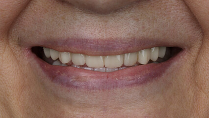 woman in old age smiling, macro photo on teeth