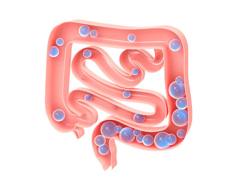 Anatomical 3d illustration of the large and small intestine with gas. Showing the open interior and the evolution of flatulence formation. Aerophagia.