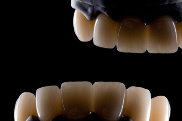 dental crowns for 3d models