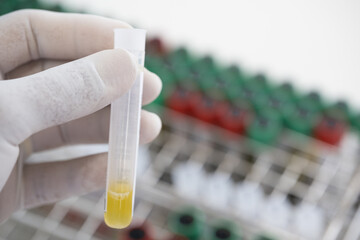 Selective focus scientist hand holding blood test tube for fast laboratory.Technician during work at biochemistry unit in hospital.
