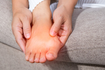 Close-up of a woman massage painful toes at home. Bare foot of woman with painful red bunion (Hallux valgus) and injury foot, Problems from wearing high heel. medical foot problem. - obrazy, fototapety, plakaty