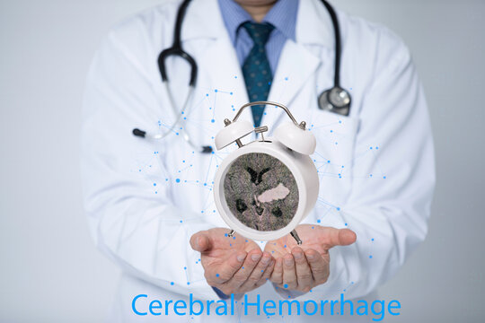 A doctor holding a clock with a CT image of an intracerebral hemorrhage. Medical urgency concept.