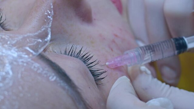 Beauty and injection concept. Cosmetology in the clinic. An experienced beautician wearing white gloves injects a subcutaneous injection with the necessary active ingredients into a woman's face for
