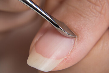 Manicure. Push back the cuticle with a metal pusher. Getting injured during a manicure. Skin care,...