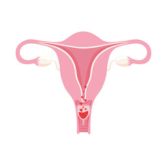 uterus with menstrual cup