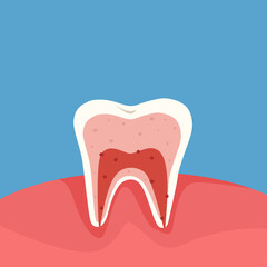 Diagram of a cross section of a tooth showing the layers of enamel, dentin, pulp with blood vessels and nerves. Dental anatomy concept. Vector cartoon illustration