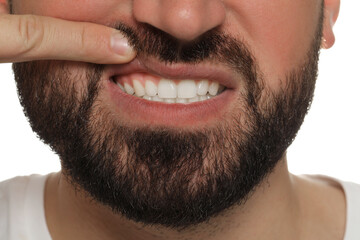 Young man showing white teeth, closeup view