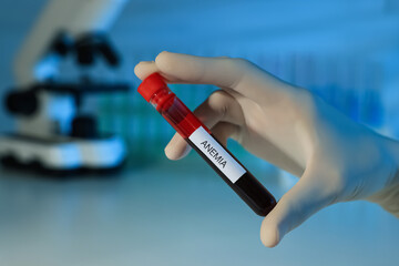 Scientist holding test tube with blood sample and label Anemia on blurred background, closeup - obrazy, fototapety, plakaty