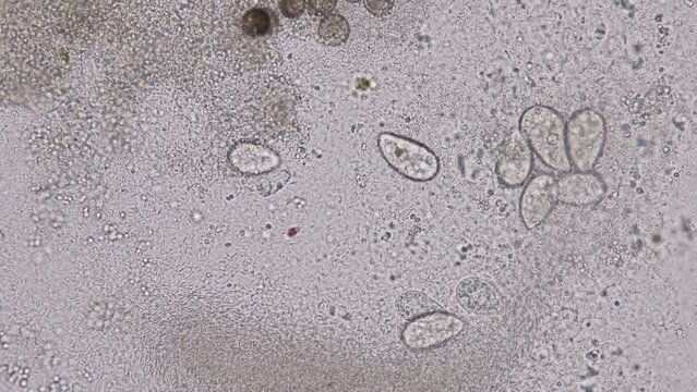 Bacteria and Protozoa in waste water under the microscope.
