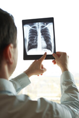 Man in shirt holds fluorography in light. Doctor shows the problem.