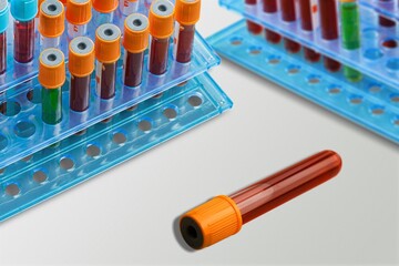 Test tube of blood for Covid-19 Variant test, blood sample with a New Variant