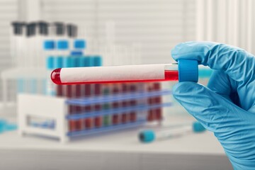 Test tube of blood for Covid-19 Variant test, blood sample with a New Variant