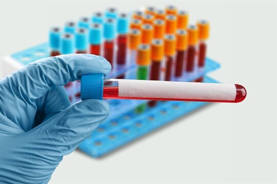 Biochemist hold test tubes with blood sample for test.