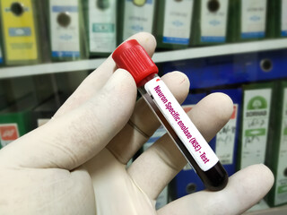 Blood sample for Neuron-specific Enolase or NSE Blood Test. To diagnosis and ongoing monitoring of...