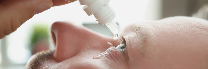 Man dripping antibacterial drops into his eye closeup