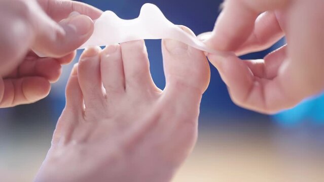 Person put on silicone toe corrector spreader on feet close-up 4K