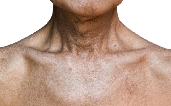 Aging and wrinkled skin at chest of Asian, Chinese old man.