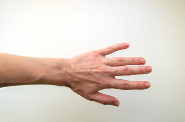 Hand with chapped skin and age-related changes
