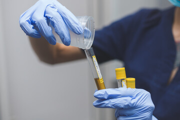 Laboratory assistant pours urine from container into test tube for placement in centrifuge