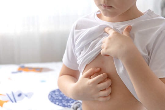 Close up of kid boy in white t-shirt scratching his body. Cooties, skin diseases concept.