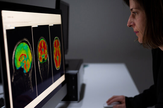 Female analyzing brain scan on computer