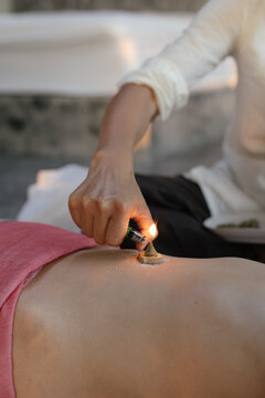 Moxibustion session