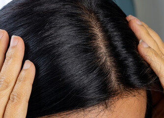 Closeup Asian woman head, natural healthy clean dark strong hair no dandruff. 