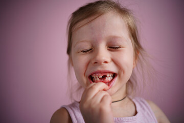 girl smiles without a front tooth. High quality photo