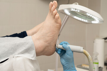 Callus peeling using professional pedicure drill machine. Spa foot treatment. Removing hard,...