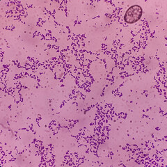 Microscopic view of Enterococcus bacteria from UTI patient urine sample, show gram-positive cocci...