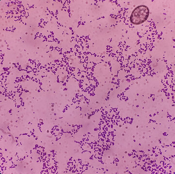 Microscopic view of Enterococcus bacteria from UTI patient urine sample, show gram-positive cocci at gram's staining slide. focus view