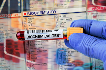 Blood tube test with requisition form for Biochemical test. Blood sample tube for analysis of...