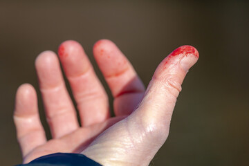 Selective focus of men hand with bleeding on thumb finger, Male right hand side wound from biting...