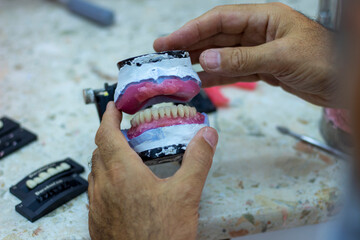 denture making