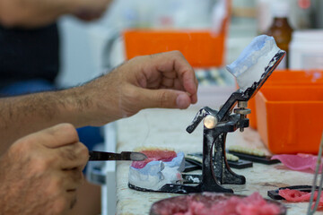 denture making