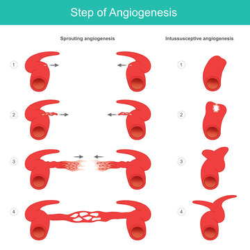 Step of Angiogenesis. Medical learning about the formation process of artery and capillary in human body. Illustration.