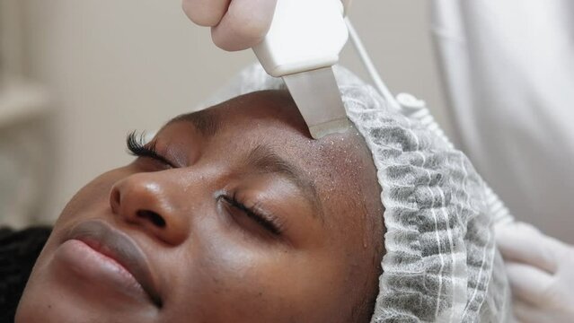 Ultrasound peeling. Face cosmetology. Skincare treatment. Woman beautician cleaning pores with ultrasonic scrubber procedure on client skin at beauty salon.