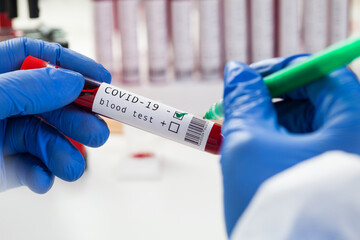 Lab scientist medical technologist labelling blood sample test tube vacutainer