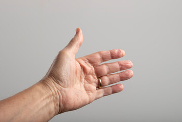 palm of a man's left hand with wedding ring