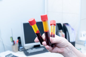 Hand of a laboratory medical worker holding blood sample in vacuum tube 