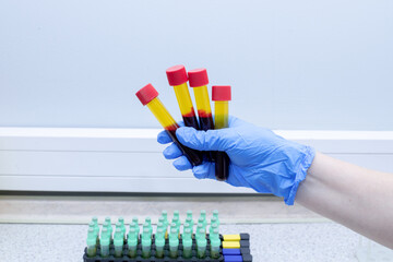 a stand with vacuum tubes with venous blood for analysis with a hand in a blue glove holding vacuum...