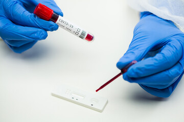 UK lab tech scientist placing blood sample on Rapid Diagnostic Test RDT cassette